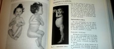 Manual practico de Pediatria – ilustrado